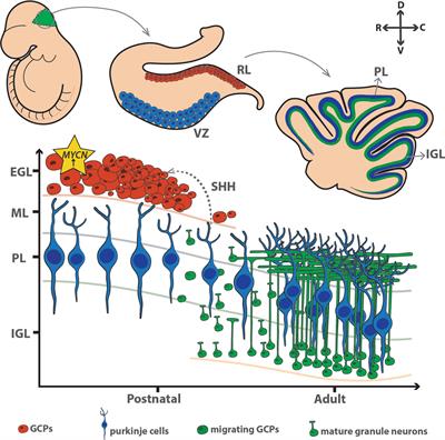 Biological Role of MYCN in Medulloblastoma: Novel Therapeutic Opportunities and Challenges Ahead